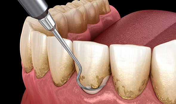 Periodoncia-TEMP